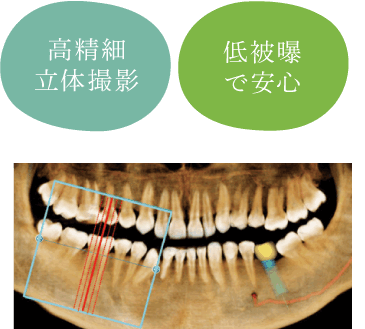 高精細立体撮影/低被曝で安心