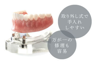 取り外し式で手入れしやすい/万が一の修理も容易